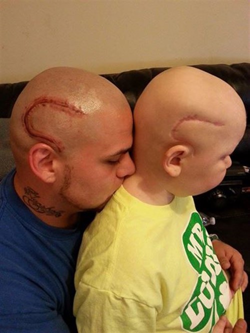 World's Greatest Dad - Brain Cancer