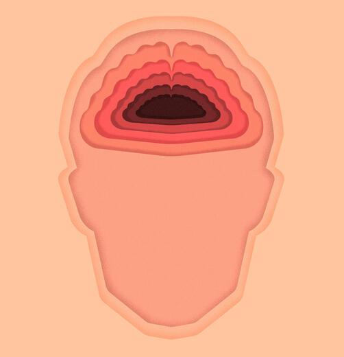 Thumbnail for original image
